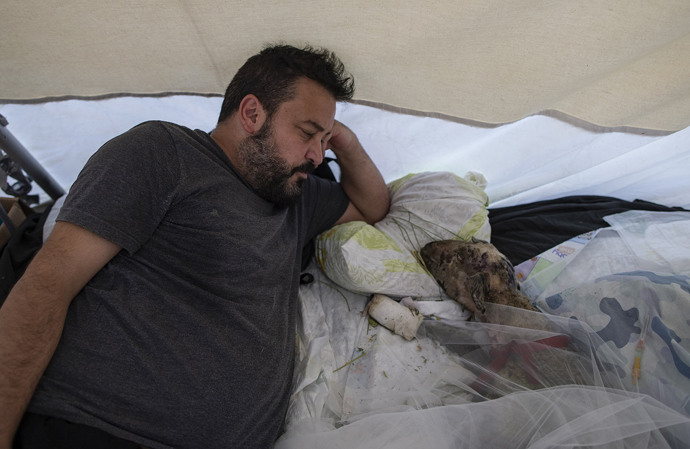 A volunteer rests with a burned sheep in a field hospital which is established by HAYTAP (The Federation of the Animals Rights in Turkey)  for animals after a wildfire at the Manavgat district of Antalya, Turkey, 09 August 2021.